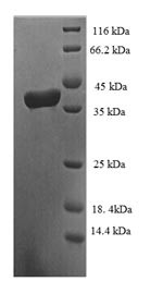 Elongin-C (ELOC), human, recombinant
