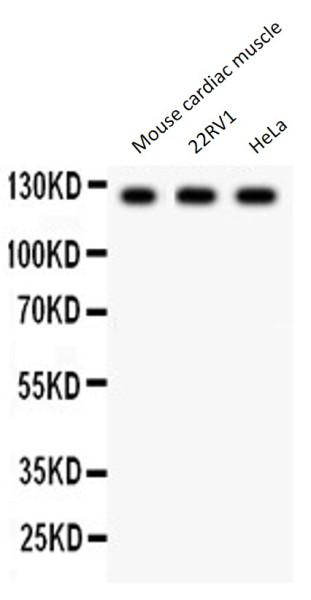 Anti-Phospholipase D1