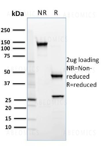 Anti-SREBP2 Monoclonal Antibody (Clone: SREBP2/1579)