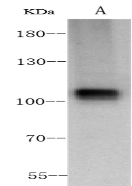 Anti-ACE2 Monoclonal Recombinant Antibody