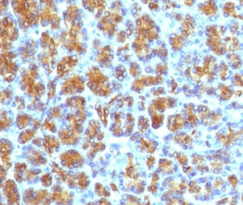 Anti-CELA3B / Elastase 3B, clone ELTS3B-4R