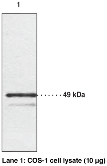Anti-Chemokine-Like Receptor 1