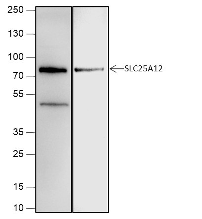 Anti-Recombinant SLC25A12, clone A655