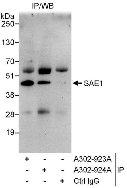 Anti-SAE1