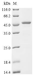 Sharpin (SHARPIN), human, recombinant