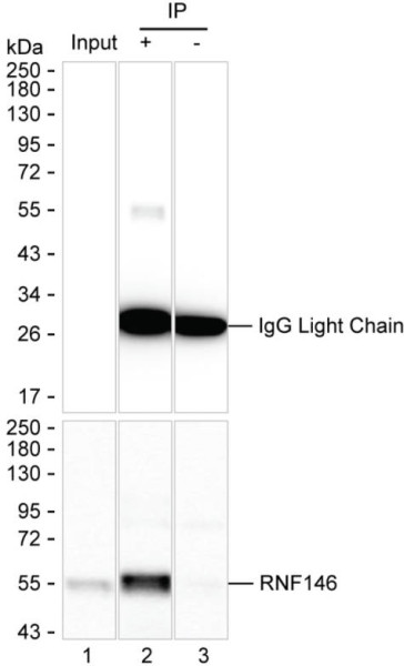 Anti-RNF146 Magnetic Beads