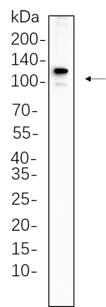 Anti-Recombinant PMS2, clone 6F12