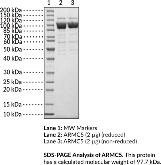 ARMC5 (human, recombinant)