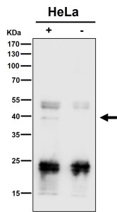 Anti-PCBP2 / Poly(rC)-binding protein 2, clone 30P20