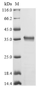Gingipain R2 (rgpB), partial, Porphyromonas gingivalis, recombinant
