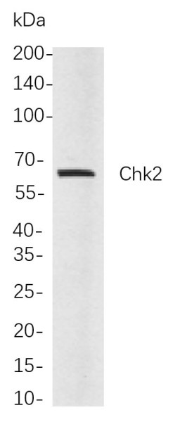 Anti-Recombinant Chk2, clone 5F3
