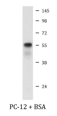 Anti-phospho-phospho-Smad 2 + 3 (Ser465/467) / (Ser423/425)