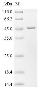 Lactosylceramide alpha-2,3-sialyltransferase (ST3GAL5), partial, human, recombinant
