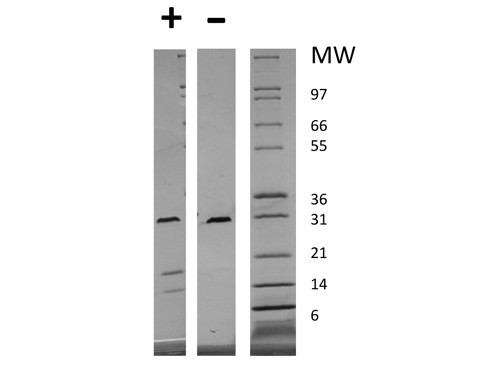 Platelet Derived Growth Factor-AB (AF)