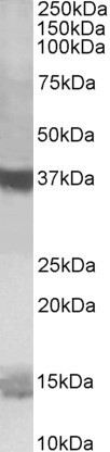 Anti-Prefoldin, C-terminal