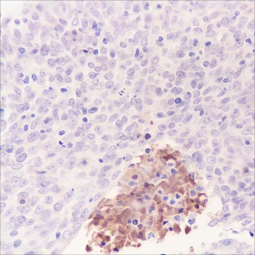 Anti-Recombinant Tenascin X, clone A375