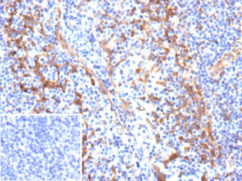 Anti-ALCAM / Activated leukocyte cell adhesion molecule, clone rALCAM/9811