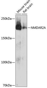 Anti-NMDAR2A