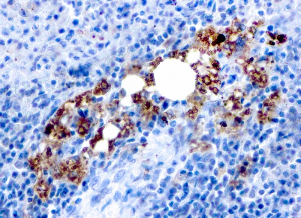 Anti-TRAcP (Tartrate-Resistant Acid Phosphatase) (Hairy Cell Leukemia Marker), recombinant antibody,