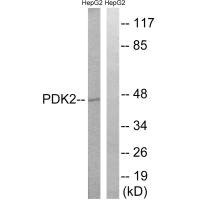 Anti-PDK2