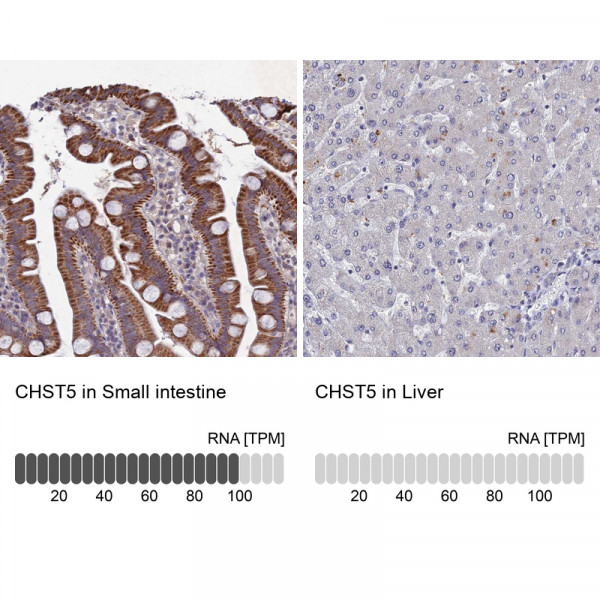 Anti-CHST5