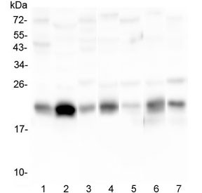 Anti-Caveolin-3 / CAV3
