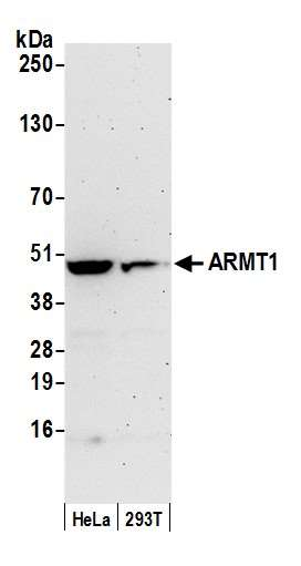 Anti-ARMT1