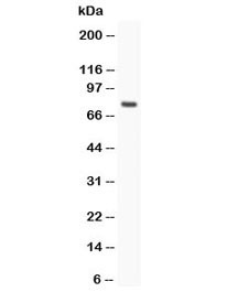 Anti-hCG receptor