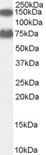 Anti-ACOX2, Internal