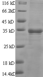 Prostate stem cell antigen (PSCA), human, recombinant