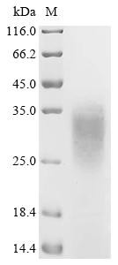 Platelet glycoprotein Ib beta chain (GP1BB), partial, human, recombinant
