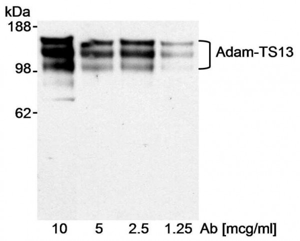 Anti-ADAMTS13