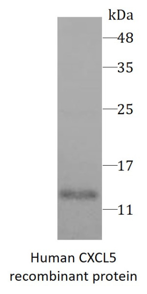 Human CXCL5 recombinant protein (Active) (His-tagged)