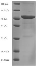 Outer membrane protein Omp38 (omp38), Acinetobacter baumannii, recombinant