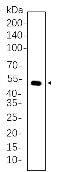Anti-Recombinant Cytokeratin 14, clone 6H6