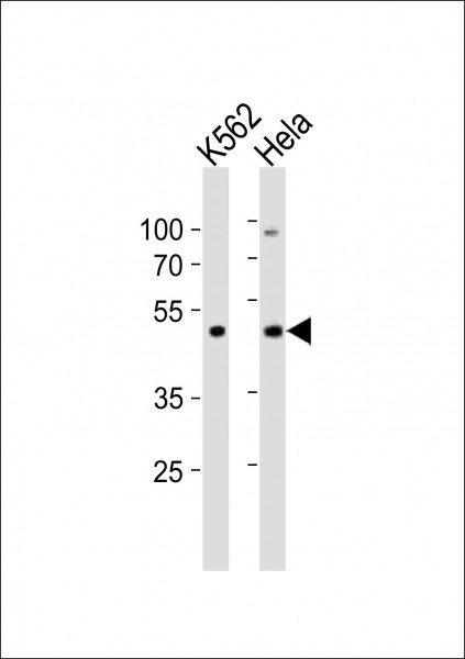 Anti-BAF53A / ACTL6A