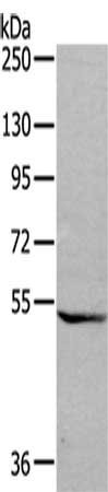 Anti-GDF7