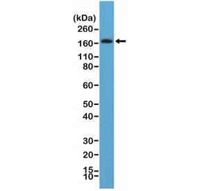 Anti-Platelet Derived Growth Factor Receptor beta / PDGFRB (C-Terminal) (recombinant antibody), clon