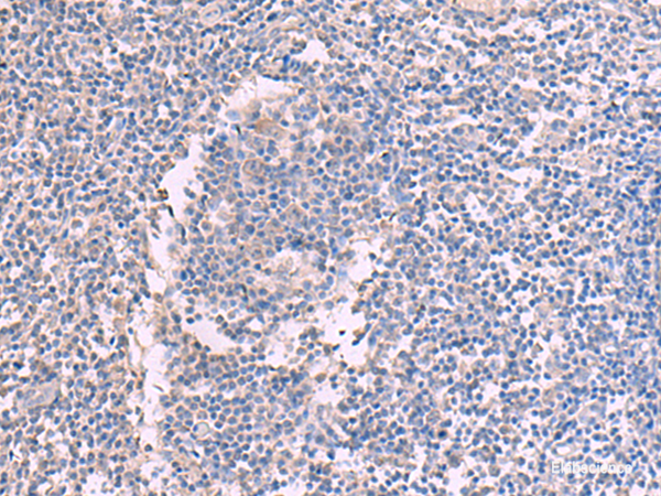Anti-CCT5