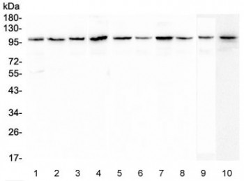 Anti-Plasminogen / PLG