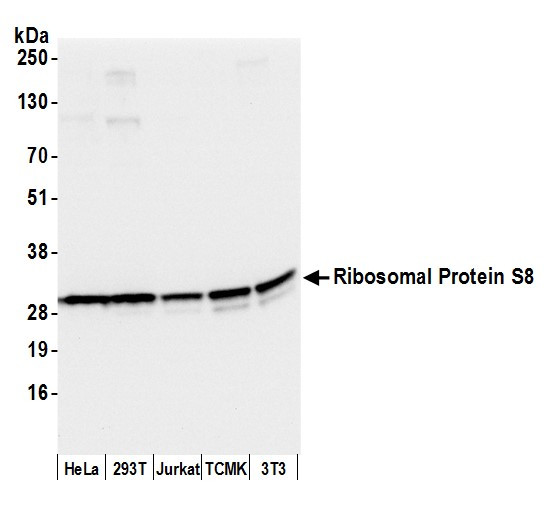 Anti-Ribosomal Protein S8/RPS8