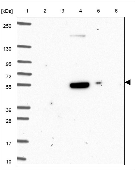 Anti-KCNJ2