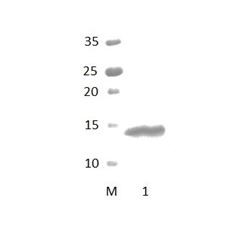 DLG5_3 PDZ Domain