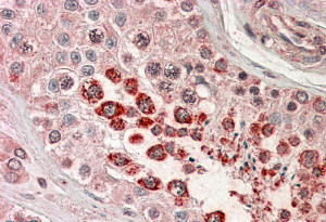 Anti-XAGE1 (Isoform 1d) / GAGED2, C-terminal