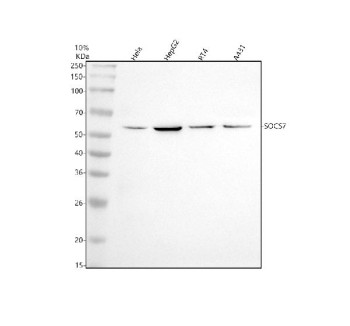 Anti-SOCS7 / Suppressor of cytokine signaling 7, clone 30S97
