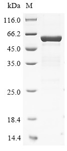 Serine/threonine-protein phosphatase 2A 55 kDa regulatory subunit B beta isoform (PPP2R2B), human, r