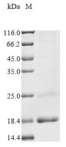 Double homeobox protein 4 (DUX4), partial, human, recombinant