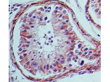 Anti-TLR4, clone 76B357.1