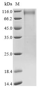 Spike glycoprotein (S), partial, human coronavirus 229E, recombinant