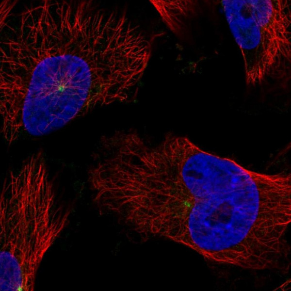 Anti-CDK5RAP2